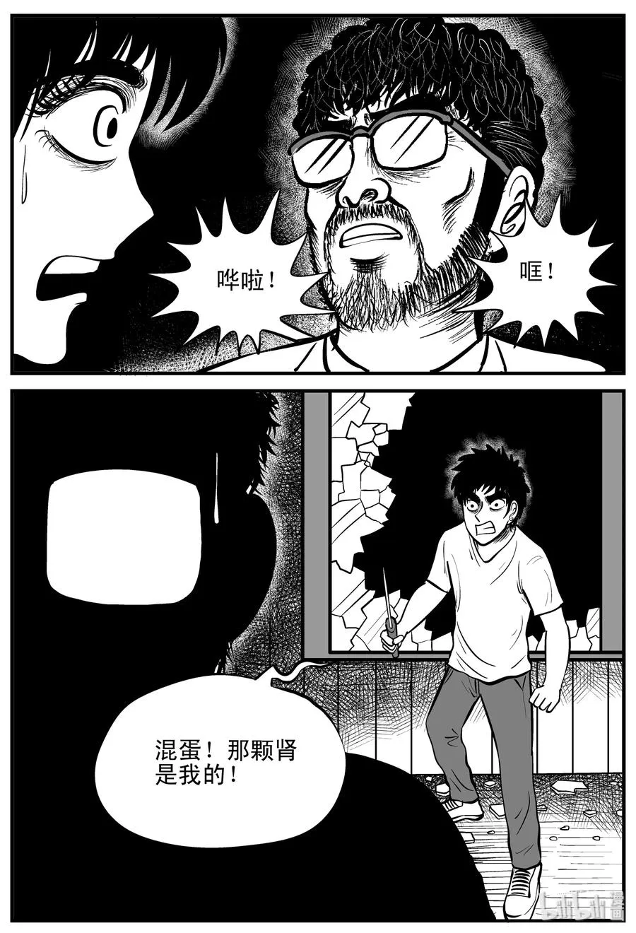 206 谁偷了我的肾（2）4